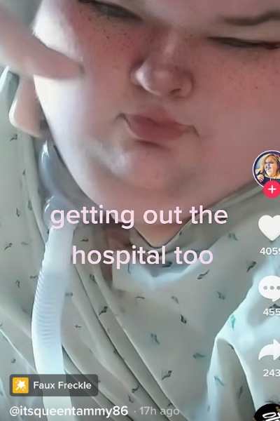 1000-LB SISTERS Why Tammy Slaton has a tube in her neck