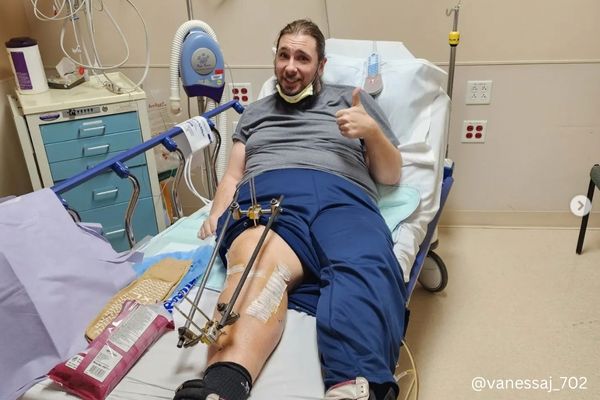 Colt and Vanessa are quitting 90 DAY FIANCÉ shows after horrible trampoline accident
