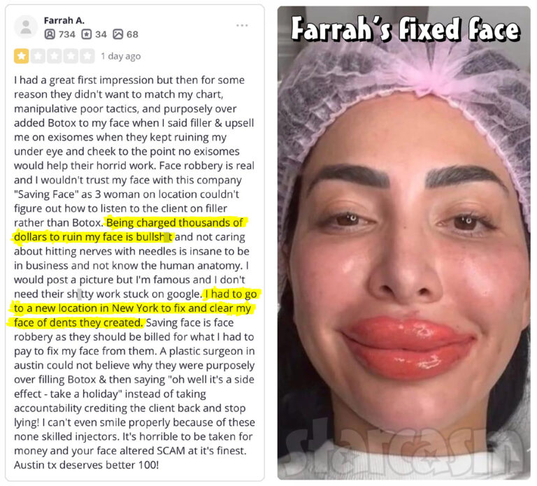 Farrah Abraham botched face and lips