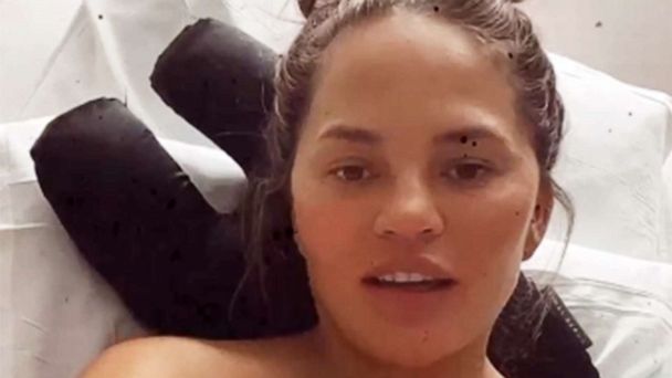 Chrissy Teigen praises surrogate; names names and shows her photo