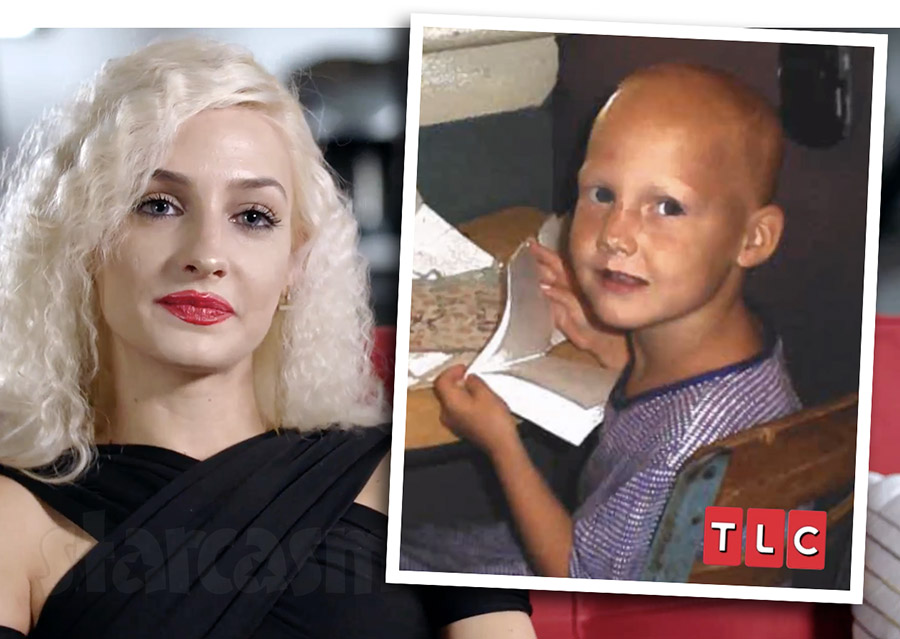 Moriah Plath lost her hair as a child, made fun of by siblings VIDEO