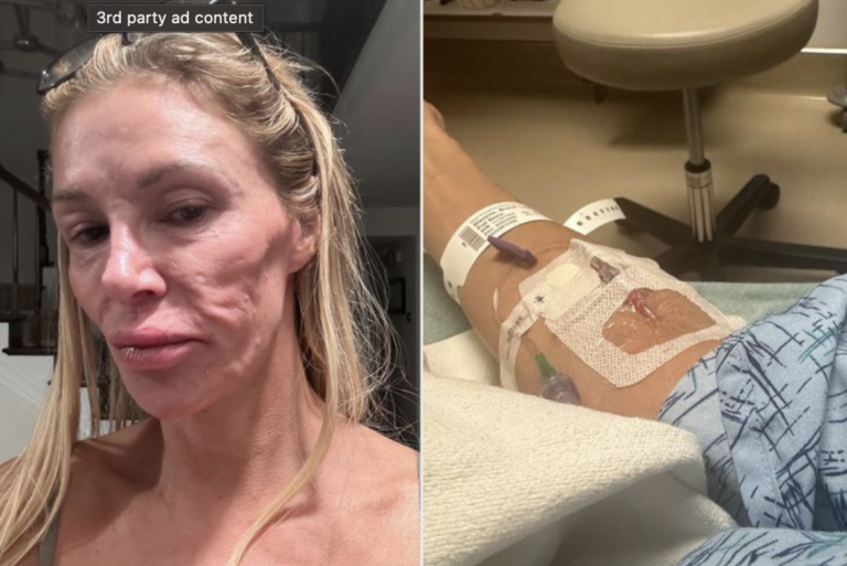 RHUGT Why is Brandi Glanville in the hospital?