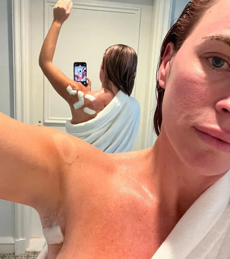 RHOBH Teddi Mellencamp skin cancer update