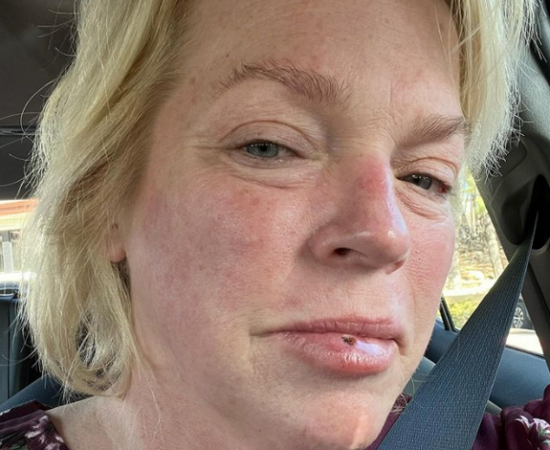 janelle brown cancer photo