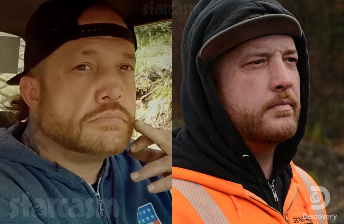 Rick Ness from Gold Ruch before and after nose photos