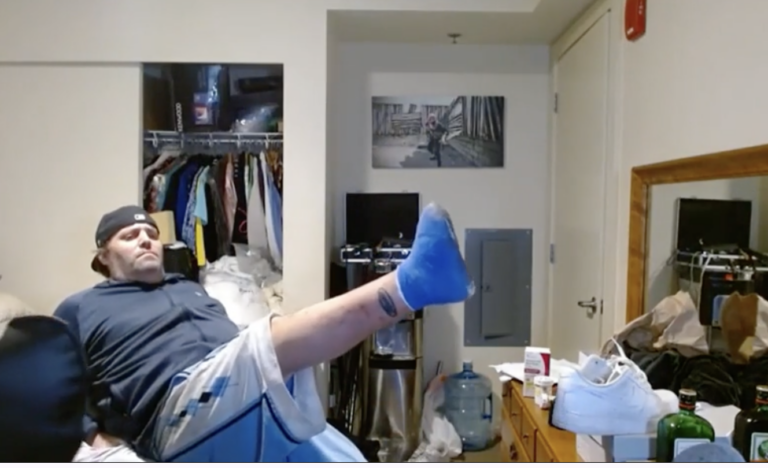 Drinking Streamer OnlyUseMeBlade shows his toe amputation, police later ended his stream