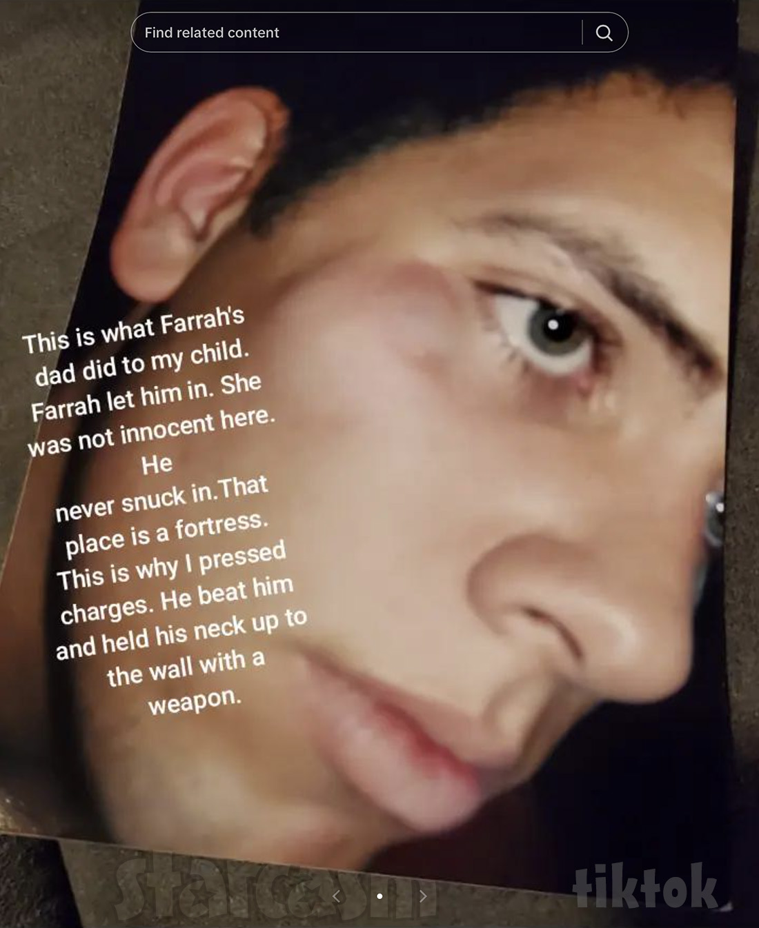 Farrah Abraham's ex Derek Underwood with facial injuries allegedly caused by Farrah's dad Michael Abraham.